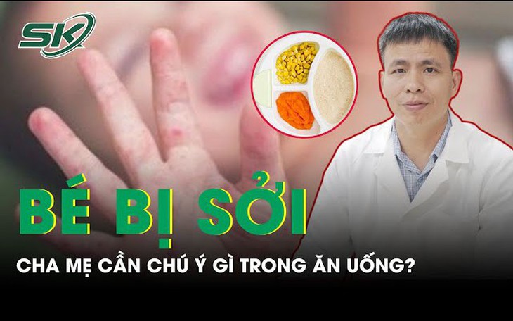 Bé bị sởi cần chú ý gì trong ăn uống?