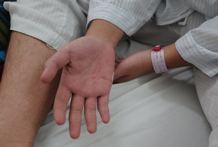 Phòng chống Sốt xuất huyết mong đợi giải pháp hiệu quả, bền vững- Ảnh 1.