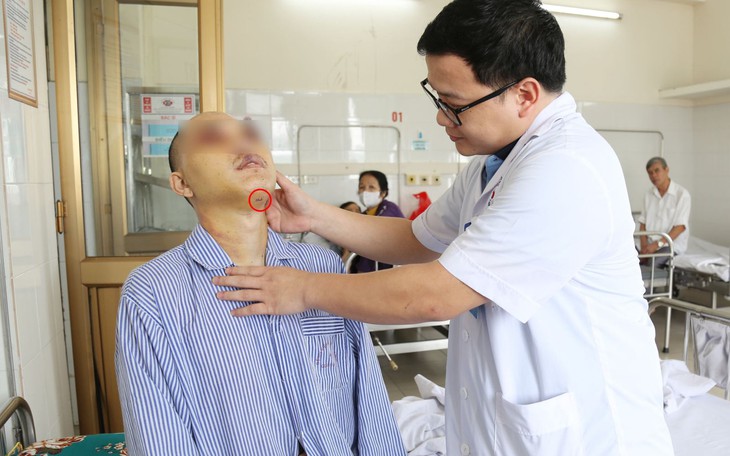 Lần đầu tiên đặt ống nội khí quản đường dưới cằm cho bệnh nhân chấn thương hàm mặt