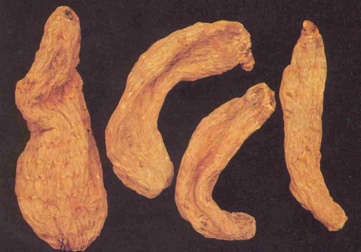 Món ăn bài thuốc hỗ trợ điều trị chứng hoa mắt chóng mặt- Ảnh 3.