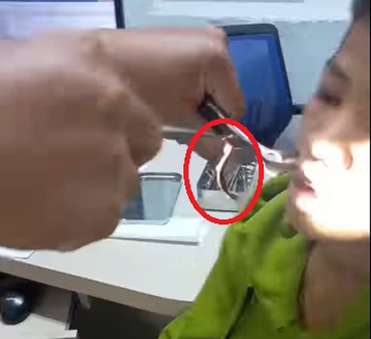 Video bác sĩ gắp con vắt dài 8cm trong mũi bé trai sau khi uống nước ở khe suối- Ảnh 2.