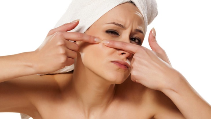 Tác hại khi nặn mụn không đúng cách- Ảnh 2.