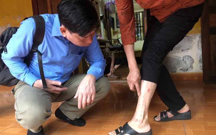 Hàng chục người 