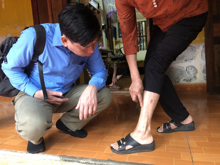 Nguyên nhân khiến hàng chục người ở Thanh Hóa nổi ngứa toàn thân- Ảnh 1. Nguyên nhân khiến hàng chục người ở Thanh Hóa nổi ngứa toàn thân- Ảnh 1.