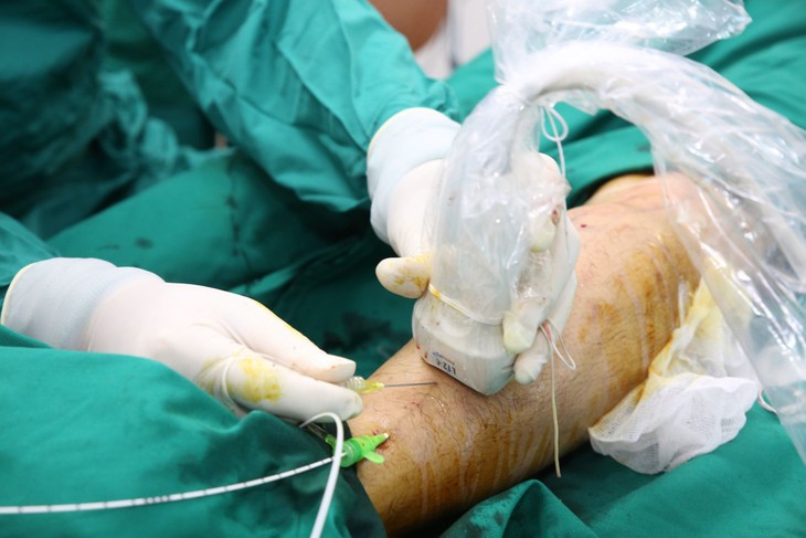 Điều trị suy giãn tĩnh mạch bằng laser nội mạch- Ảnh 1. Điều trị suy giãn tĩnh mạch bằng laser nội mạch- Ảnh 1.