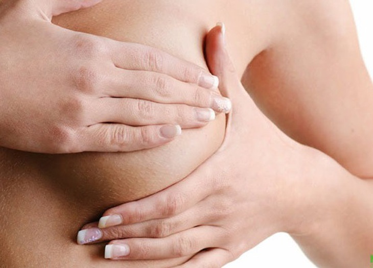 Tắc tia sữa: Nguyên nhân, triệu chứng, cách điều trị và phòng bệnh- Ảnh 1.