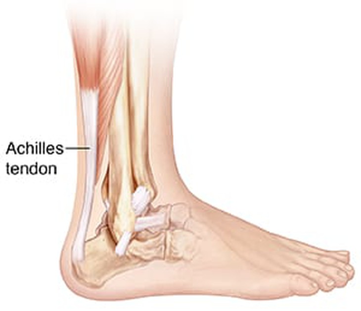 Khoảng 80% tổn thương gân ở mức độ rách một phần nhỏ có thể hồi phục trong thời gian từ 3 đến 6 tháng hoặc lâu hơn khi điều trị bảo tồn như nghỉ ngơi, tránh các bài tập nặng và khó. Khoảng 80% tổn thương gân ở mức độ rách một phần nhỏ có thể hồi phục trong thời gian từ 3 đến 6 tháng hoặc lâu hơn khi điều trị bảo tồn như nghỉ ngơi, tránh các bài tập nặng và khó.