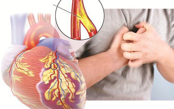 3 lưu ý tự chăm sóc bản thân khi mắc suy tim