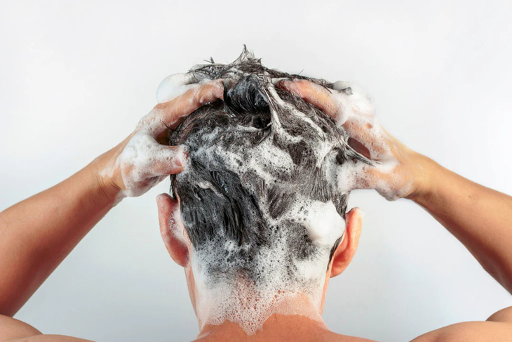 7 điều cần làm để trị gàu ngứa mùa nắng nóng- Ảnh 2.