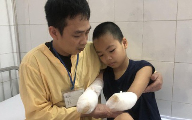 Xót xa trước ước mong của bé gái 12 tuổi mất đi đôi tay vì bỏng điện