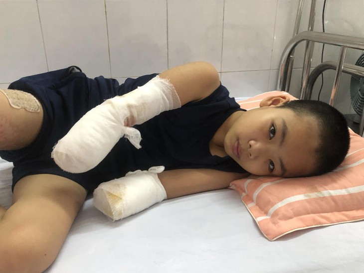Xót xa trước ước mong của bé gái 12 tuổi mất đi đôi tay vì bỏng điện- Ảnh 1. Xót xa trước ước mong của bé gái 12 tuổi mất đi đôi tay vì bỏng điện- Ảnh 1.