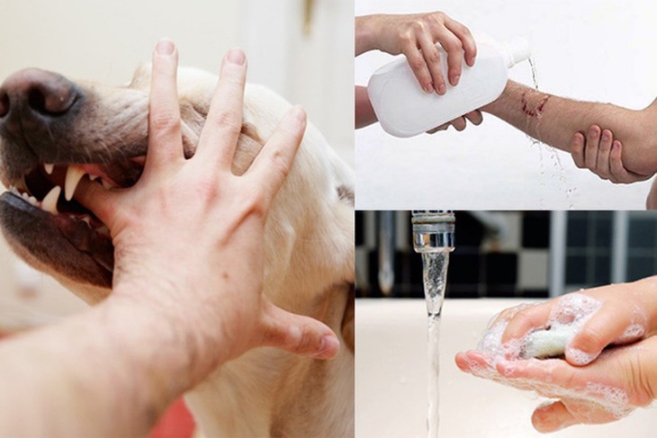 Nhanh chóng làm các động tác sơ cứu như vết thương do động vật cắn. Nhanh chóng làm các động tác sơ cứu như vết thương do động vật cắn.