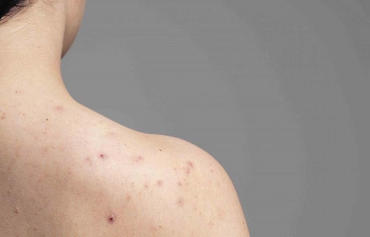 Không mua và dùng những mỹ phẩm kém chất lượng, không rõ nguồn gốc. Ảnh minh họa Không mua và dùng những mỹ phẩm kém chất lượng, không rõ nguồn gốc. Ảnh minh họa