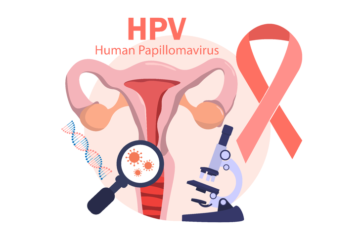 Một virus phổ biến gây bệnh ung thư nguy hiểm cho nữ giới đang bị xem nhẹ- Ảnh 1. Một virus phổ biến gây bệnh ung thư nguy hiểm cho nữ giới đang bị xem nhẹ- Ảnh 1.