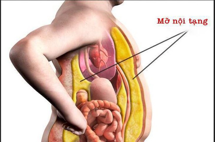 Mỡ nội tạng có hại thế nào với sức khỏe?- Ảnh 1. Mỡ nội tạng có hại thế nào với sức khỏe?- Ảnh 1.