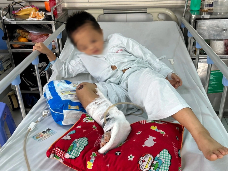 Bé trai dân tộc Mông bị tai nạn ‘nát’ một bên chân cần gấp sự cứu giúp của cộng đồng- Ảnh 1. Bé trai dân tộc Mông bị tai nạn ‘nát’ một bên chân cần gấp sự cứu giúp của cộng đồng- Ảnh 1.
