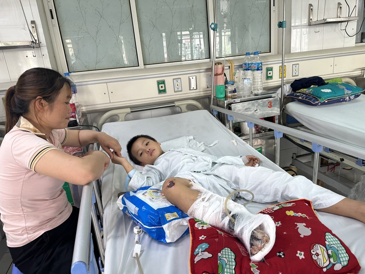 Bé trai dân tộc Mông bị tai nạn ‘nát’ một bên chân cần gấp sự cứu giúp của cộng đồng- Ảnh 2. Bé trai dân tộc Mông bị tai nạn ‘nát’ một bên chân cần gấp sự cứu giúp của cộng đồng- Ảnh 2.