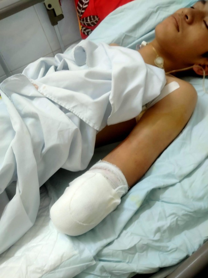 Xót thương nam thanh niên mồ côi bị bỏng nặng, có nguy cơ phải cắt bỏ cả 2 tay- Ảnh 2. Xót thương nam thanh niên mồ côi bị bỏng nặng, có nguy cơ phải cắt bỏ cả 2 tay- Ảnh 2.