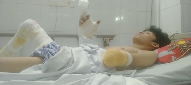 Xót thương nam thanh niên mồ côi bị bỏng nặng, có nguy cơ phải cắt bỏ cả 2 tay- Ảnh 1. Xót thương nam thanh niên mồ côi bị bỏng nặng, có nguy cơ phải cắt bỏ cả 2 tay- Ảnh 1.