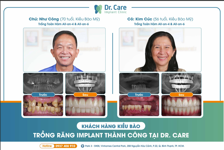 Địa chỉ trồng răng Implant được nhiều kiều bào lựa chọn- Ảnh 3.