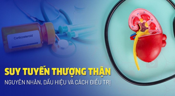 Uống thuốc chống viêm chữa đau lưng kéo dài, người phụ nữ béo bụng, da mỏng, bác sĩ cảnh báo bệnh suy tuyến thượng thận- Ảnh 1.