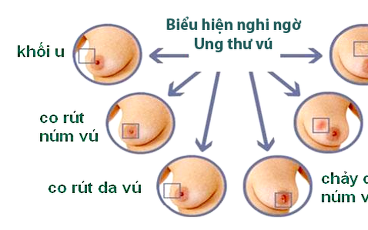 Tại sao tuổi cao trở thành yếu tố nguy cơ của ung thư?