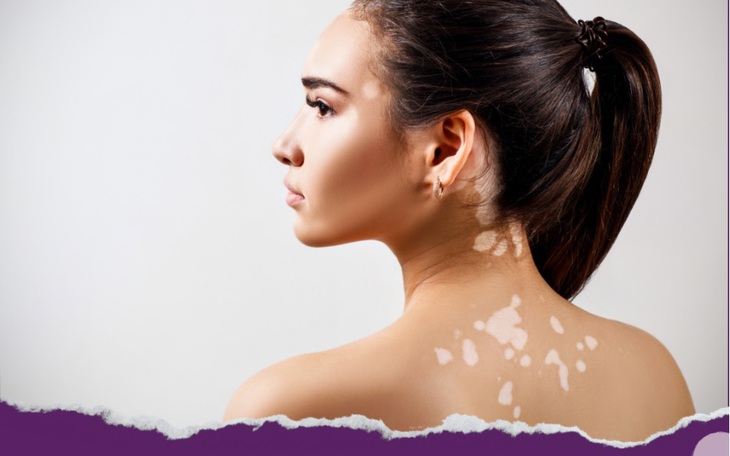 7 dấu hiệu cảnh báo bạn có thể mắc căn bệnh 