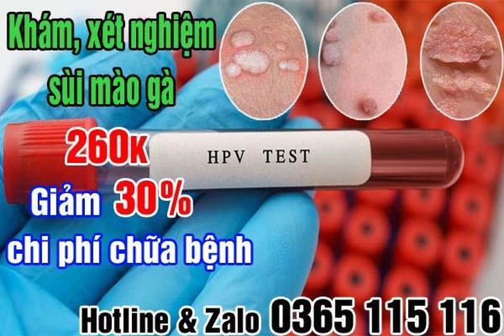 Địa chỉ khám chữa bệnh sùi mào gà ở Hà Nội hiệu quả tốt- Ảnh 1.