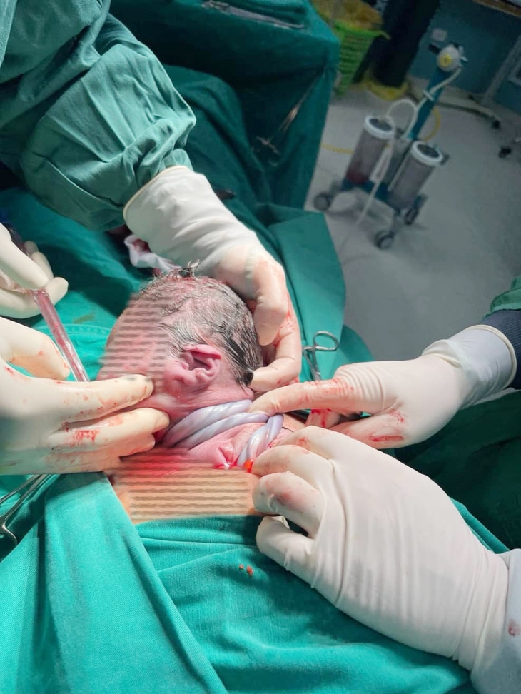 Cứu sống thai nhi có dây rau quấn cổ 3 vòng, suy thai- Ảnh 1.