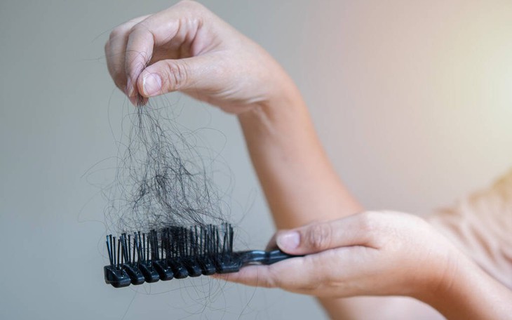 Rụng tóc có phải do gội đầu quá nhiều?