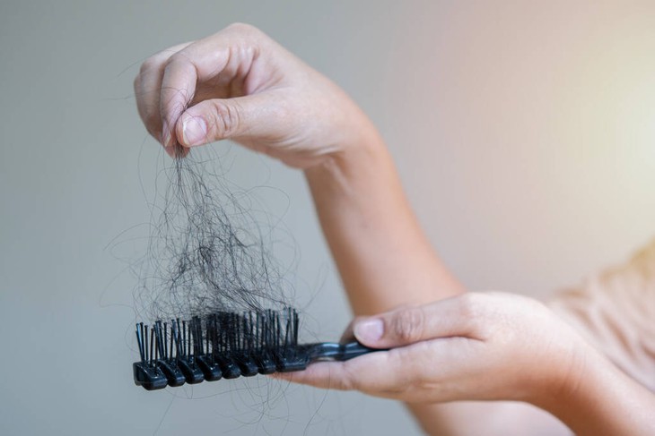 Rụng tóc có phải do gội đầu quá nhiều?- Ảnh 1. Rụng tóc có phải do gội đầu quá nhiều?- Ảnh 1.