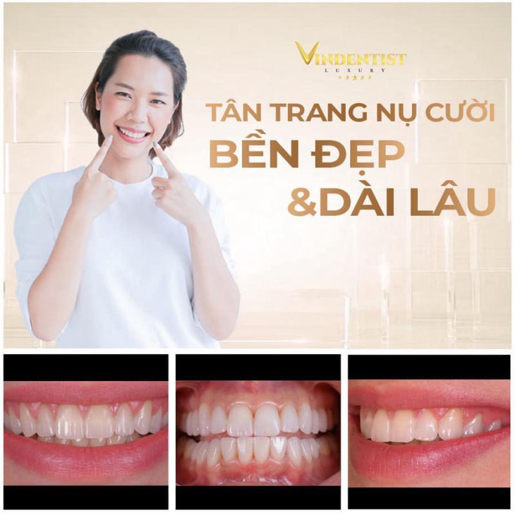 Nụ cười rạng ngời - Tự tin tỏa sáng cùng Nha khoa Thẩm mỹ VIN Dentist tại Đà Nẵng- Ảnh 2. Nụ cười rạng ngời - Tự tin tỏa sáng cùng Nha khoa Thẩm mỹ VIN Dentist tại Đà Nẵng- Ảnh 2.