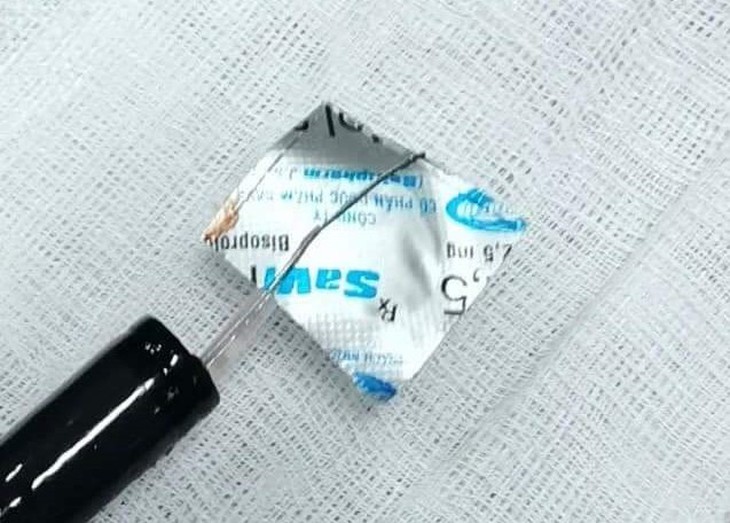 Vỏ thuốc sắc nhọn nằm sâu trong thực quản cụ bà 88 tuổi có nhiều bệnh nền- Ảnh 1. Vỏ thuốc sắc nhọn nằm sâu trong thực quản cụ bà 88 tuổi có nhiều bệnh nền- Ảnh 1.