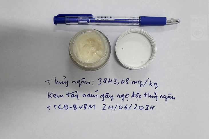 Hôn mê, tổn thương não, suy thận sau 1 năm dưỡng da bằng kem tẩy nám chứa thủy ngân- Ảnh 2.