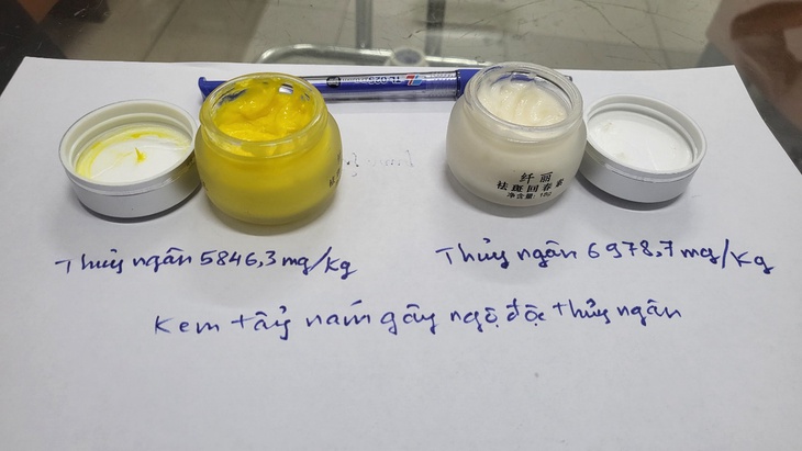 Hôn mê, tổn thương não, suy thận sau 1 năm dưỡng da bằng kem tẩy nám chứa thủy ngân- Ảnh 3.