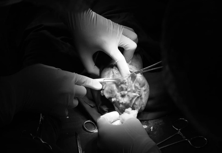 Nguy cơ cắt cụt chân do không tuân thủ điều trị đái tháo đường- Ảnh 1.