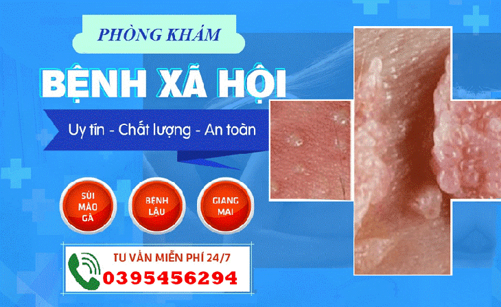 Địa chỉ khám bệnh xã hội ở Hà Nội tốt chi phí rẻ- Ảnh 1.