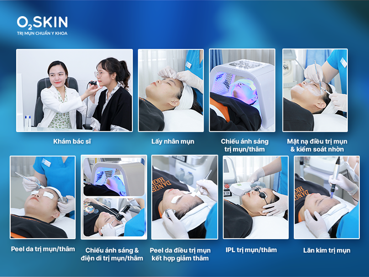 Phân biệt các loại mụn trên mặt và cách điều trị hiệu quả- Ảnh 2. Phân biệt các loại mụn trên mặt và cách điều trị hiệu quả- Ảnh 2.