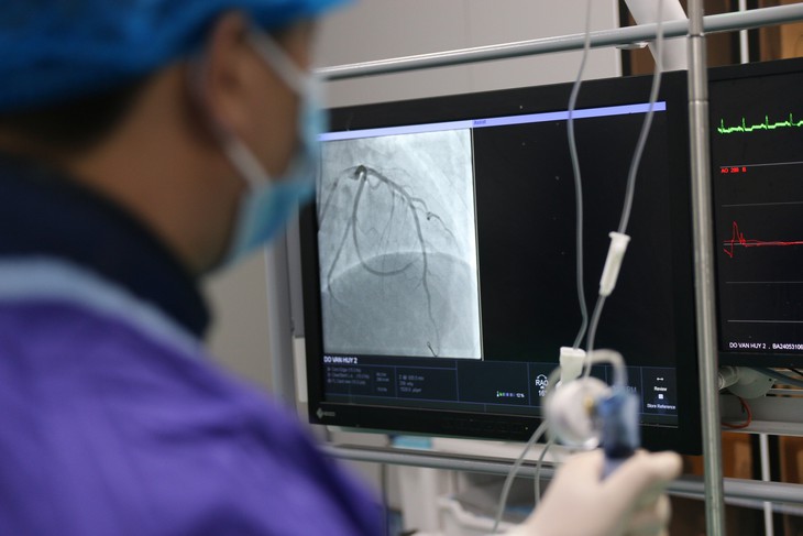 Cụ ông nhồi máu cơ tim cấp, sốc tim, tắc hoàn toàn thân chung động mạch vành trái thoát chết hi hữu- Ảnh 3. Cụ ông nhồi máu cơ tim cấp, sốc tim, tắc hoàn toàn thân chung động mạch vành trái thoát chết hi hữu- Ảnh 3.