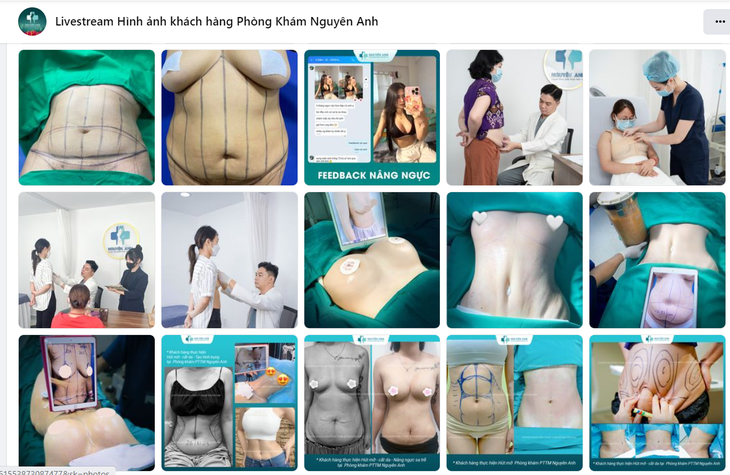 Nhồi máu não diện rộng sau hút mỡ tại Viện thẩm mỹ Nguyên Anh- Ảnh 1. Nhồi máu não diện rộng sau hút mỡ tại Viện thẩm mỹ Nguyên Anh- Ảnh 1.