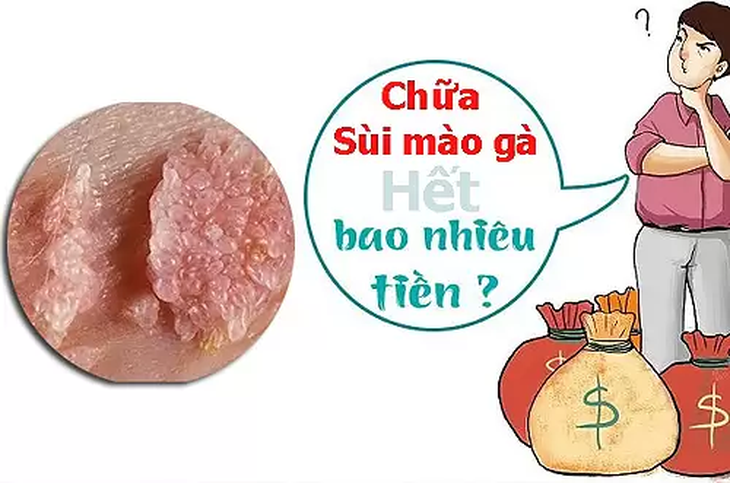 Chi phí xét nghiệm và chữa bệnh sùi mào gà hết bao nhiêu tiền?- Ảnh 1.