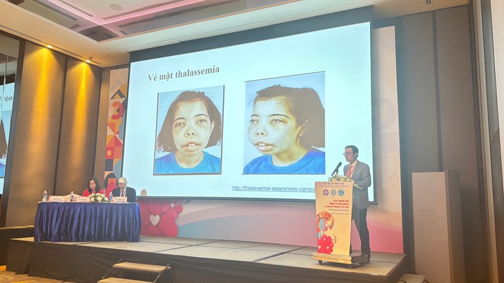 Hướng tiếp cận mới trong sàng lọc, chẩn đoán bệnh Thalassemia- Ảnh 3. Hướng tiếp cận mới trong sàng lọc, chẩn đoán bệnh Thalassemia- Ảnh 3.