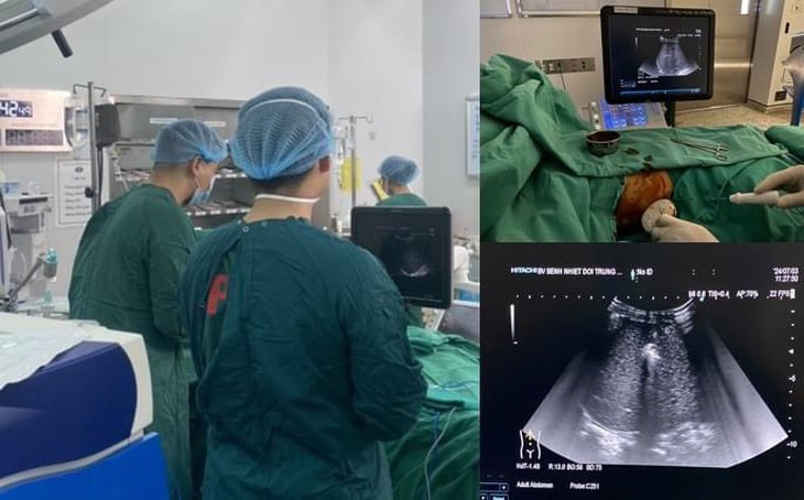 Phẫu thuật cứu bệnh nhân người dân tộc bị ung thư biểu mô tế bào gan- Ảnh 1.