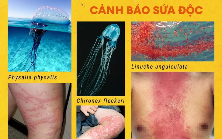 Chuyên gia chống độc chỉ cách thoát hiểm khi bị sứa lửa đốt 