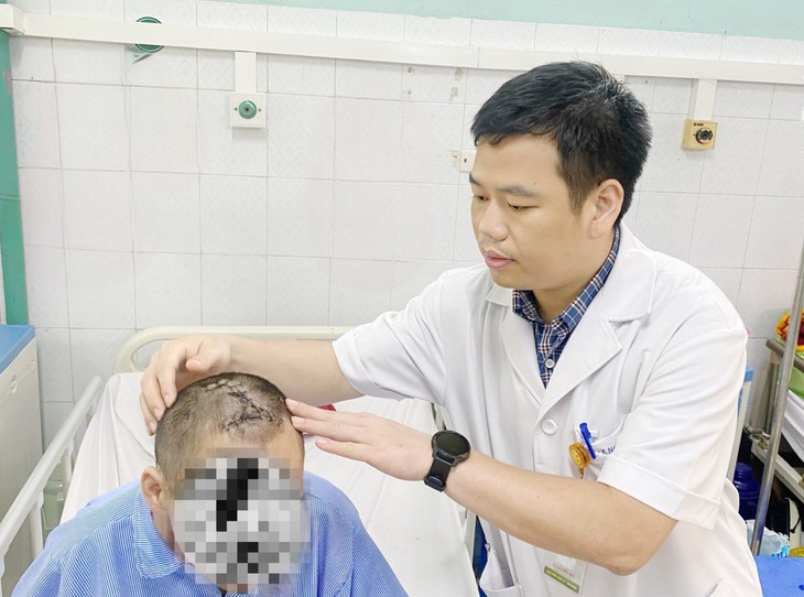 Xót xa bệnh nhân trầm cảm tự đóng đinh sắt vào đầu- Ảnh 3. Xót xa bệnh nhân trầm cảm tự đóng đinh sắt vào đầu- Ảnh 3.