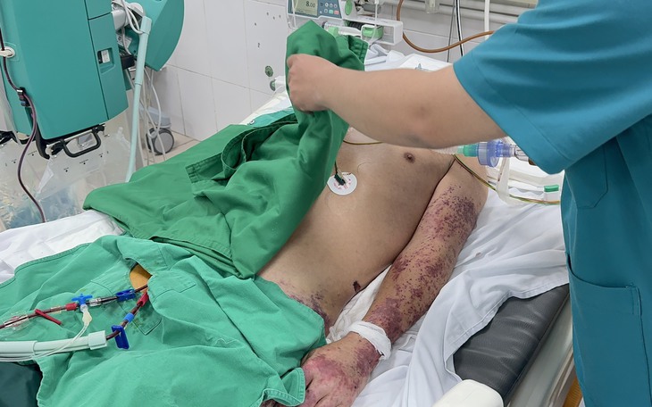 Chế biến thủ lợn, người đàn ông mắc phải căn bệnh gây chết người