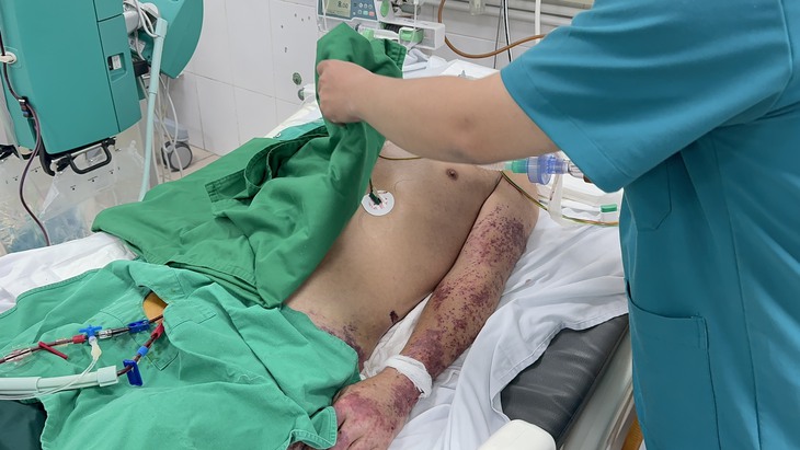 Đã có người tử vong vì nhiễm liên cầu lợn, Bộ Y tế khuyến cáo 6 cách phòng, chống bệnh- Ảnh 1. Đã có người tử vong vì nhiễm liên cầu lợn, Bộ Y tế khuyến cáo 6 cách phòng, chống bệnh- Ảnh 1.