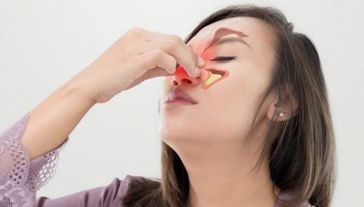 Viêm mũi dị ứng mùa mưa- Ảnh 1.