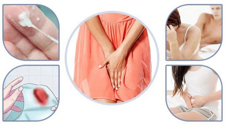 Sản phẩm chăm sóc sức khỏe phụ khoa mara eva đến từ Ý- Ảnh 1. Sản phẩm chăm sóc sức khỏe phụ khoa mara eva đến từ Ý- Ảnh 1.