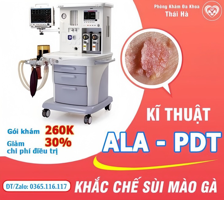 Dấu hiệu sùi mào gà ở nam giới và phụ nữ- Ảnh 1.